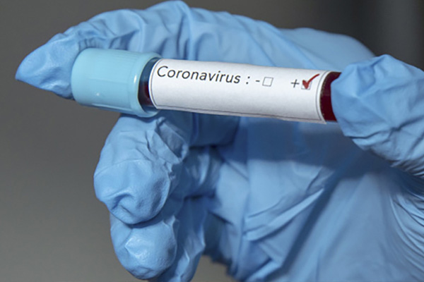 BM: Suriye, salgınını önleyemez