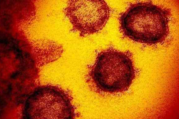 Rus Profesör Potehin: Koronavirüs salgını yazın da sürecek