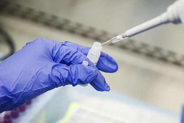 Uzmanlar uyardı: Koronavirüs testlerinde ''yalancı negatiflik''