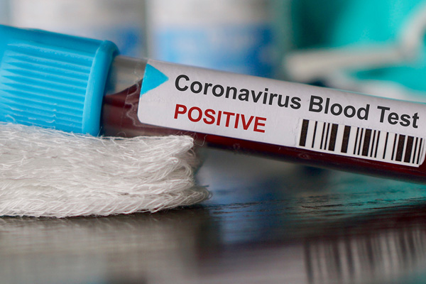 Ebeveynlere uyarı: Salgınla ilgili haberleri izlerken abartılı tepkiler vermeyin