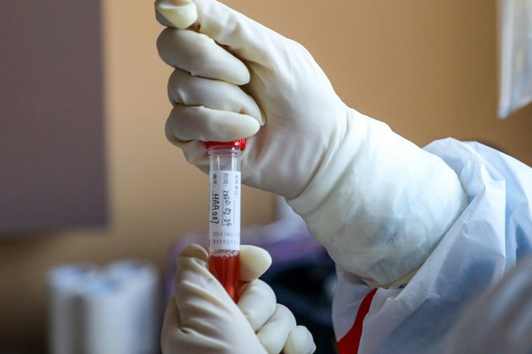 Dünya genelinde kaç kişi koronavirüsü yendi?