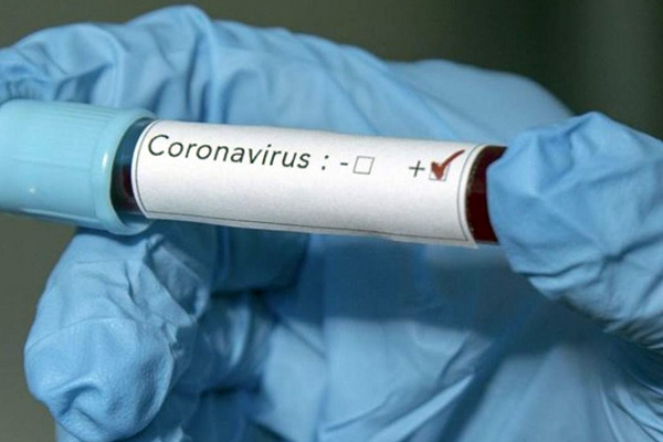 ABD'den koronavirüs kan testine onay