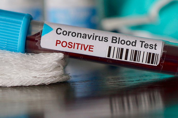 İran'da koronadan ölenlerin sayısı 3 bin 452'ye çıktı