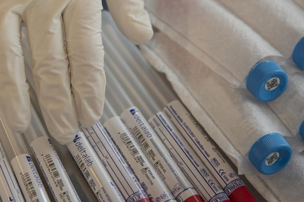 Japonya’dan sevindiren karar: Koronavirüse iyi gelen ilaç ücretsiz dağıtacak