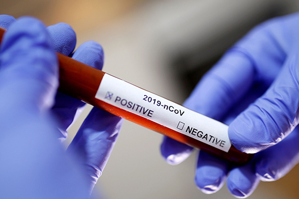 Bir işadamı, büyük bir kentte 276 kişiye korona bulaştırmış!