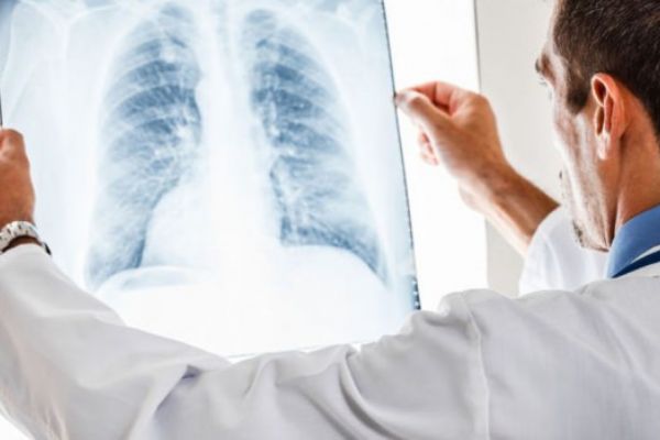 Astım ve KOAH hastalarına salgın sürecinde 'ilaç kullanma' uyarısı