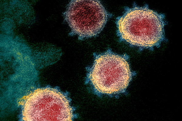 TÜBİTAK'ın Kovid-19'a karşı tıbbi malzeme geliştirme çağrısına yoğun başvuru