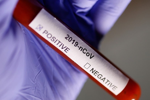 Son 24 saat: İran ve İspanya'da toplam ölü sayısı 18 bin 500'ü geçti