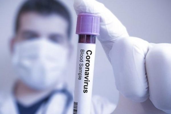 Üst solunum hastalığı ile Kovid-19 farkı