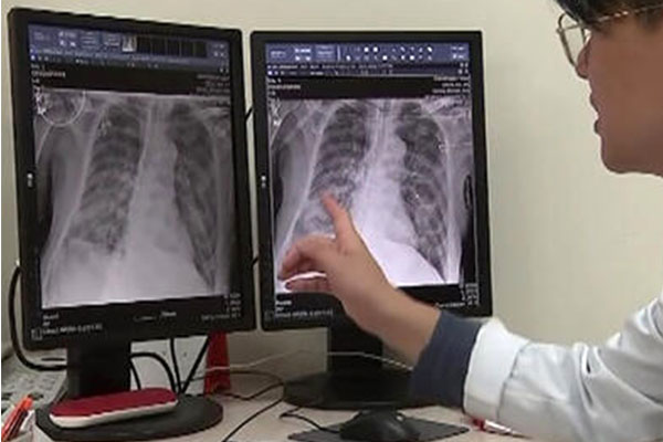 Koronavirüs tedavisi ücretsiz oldu