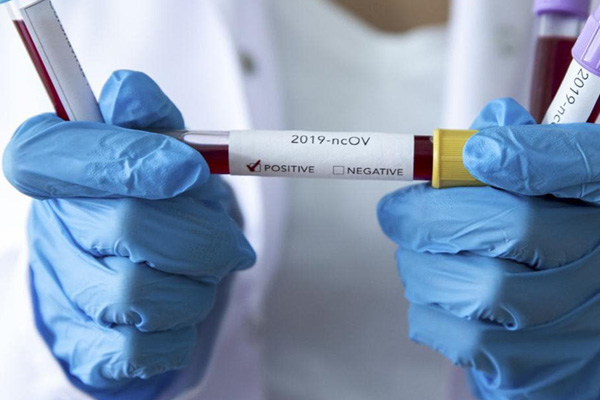 Bilim Kurulu Üyesi Yamanel'den umutlandıran açıklama: Koronavirüsün artış hızı kırıldı