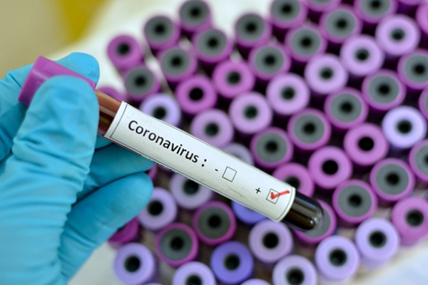 Dünya genelinde Kovid-19 bulaşan kişi sayısı 2 milyon 250 bini geçti