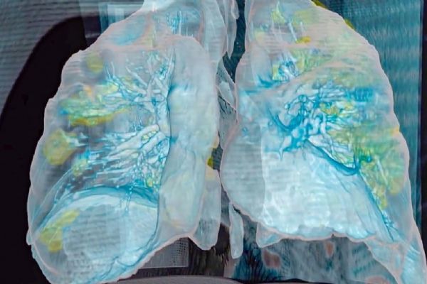 İşte koronavirüsün vücuttaki yolculuğu