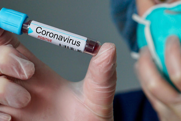 Dünya genelinde koronavirüs vaka sayısı 2,5 milyonu aştı