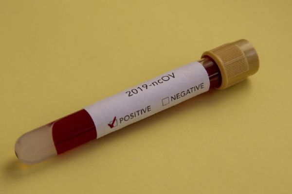 Dünya genelinde koronavirüs bulaşan kişi sayısı 2 milyon 726 bini geçti