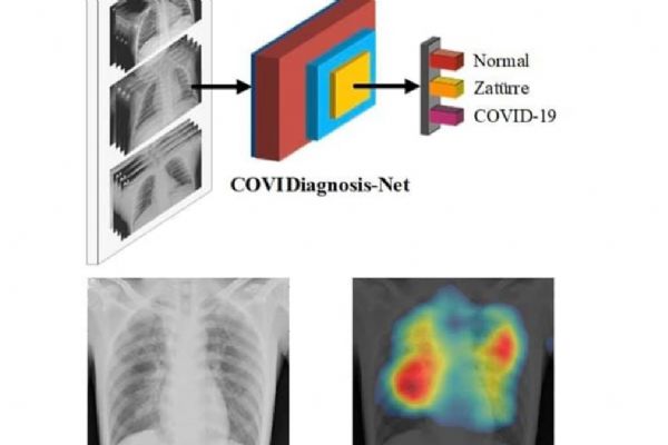 Koronavirüs teşhisini kolaylaştıracak yapay zeka sistemi