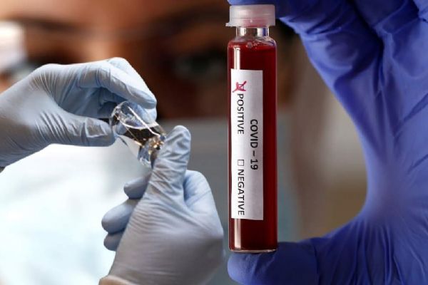 Türkiye için çok önemli koronavirüs uyarısı