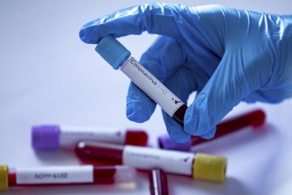 Arjantin'de salgın nedeniyle karantina 10 Mayıs'a kadar uzatıldı