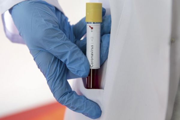 Rusya'da son 24 saatte 9 bin 623 kişide daha koronavirüs tespit edildi