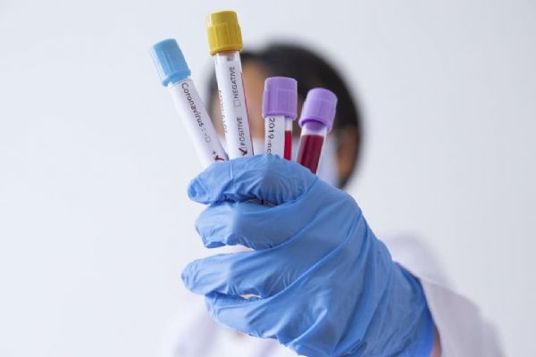 İspanya'da 276 kişi daha koronavirüs nedeniyle hayatını kaybetti