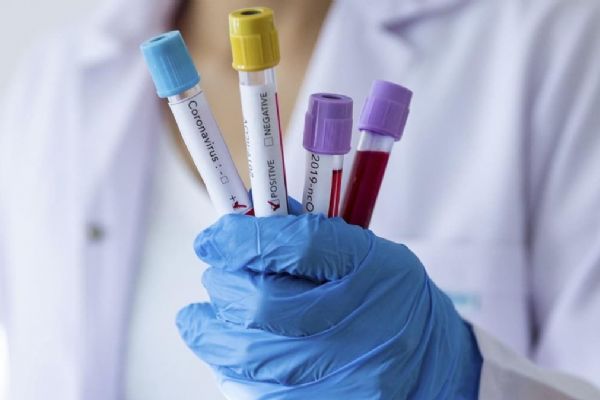 ABD'de Kovid-19 nedeniyle hayatını kaybedenlerin sayısı 65 bin 783 oldu