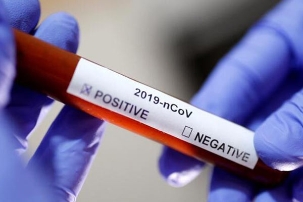 İran'da koronavirüsten ölenlerin sayısı 6 bin 541’e yükseldi