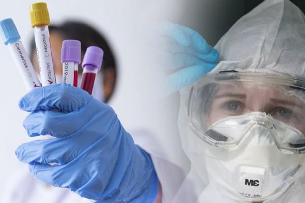 ''Koronavirüs 30 derecede bulaşıcı aktivitesini kaybediyor''