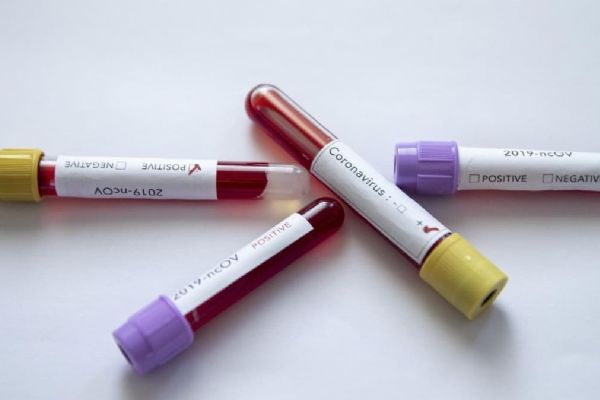 Japonya'dan koronavirüs tedavisi için yeni ilaç umudu