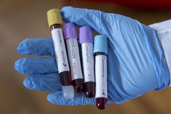 ABD'de hastalarından Kovid-19 bulaşan Türk doktor hayatını kaybetti