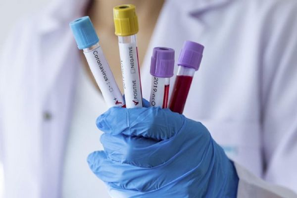 Sıcak hava, Kovid-19'un yayılmasını engellemede çok da etkili değil