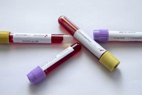 Fransa'da koronadan ölenlerin sayısı 27 bine yaklaştı