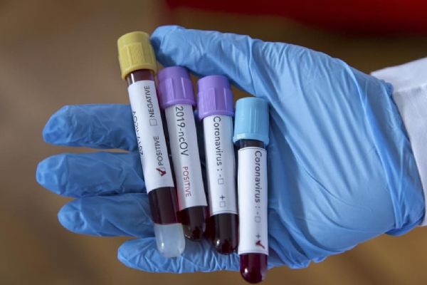 Koronavirüsten iyileşenlerin sayısı dünya genelinde 1 milyon 600 bini geçti