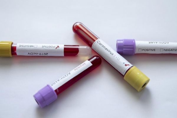 Brezilya'da koronavirüs vaka sayısı 178 bini aştı