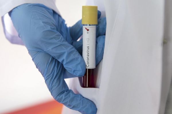 Japonya hızlı test kitlerine yeşil ışık yaktı