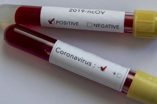 Bulgaristan'da koronavirüs nedeniyle 102 kişi hayatını kaybetti