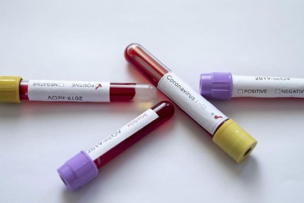 Rusya'da 10 bin 598 kişide daha koronavirüs tespit edildi