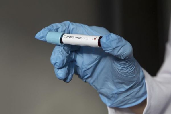 Avrasya ülkelerinde Kovid-19 vakaları ve ölümler artıyor