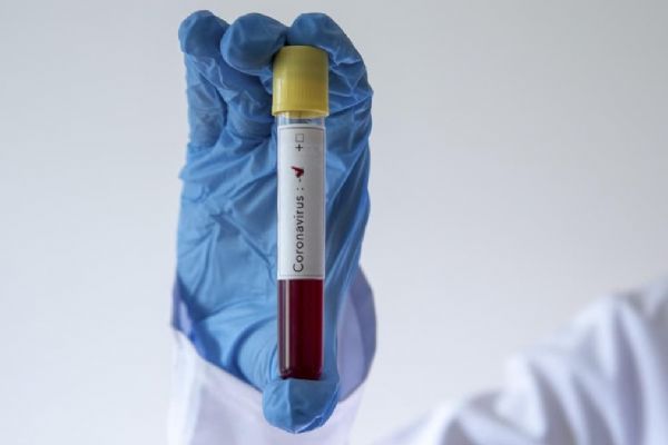 Nijerya'da koronavirüs görülen kişi sayısı 5 binin üzerine çıktı