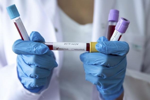 Brezilya'da Kovid-19 nedeniyle ölenlerin sayısı 14 bin 817'ye yükseldi