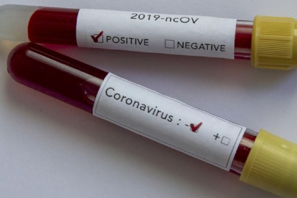 Rusya'da 9 bin 200 kişide daha koronavirüs tespit edildi