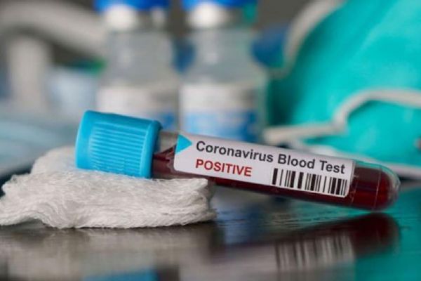 Sudan'da Kovid-19 vaka sayısı 2 bini geçti