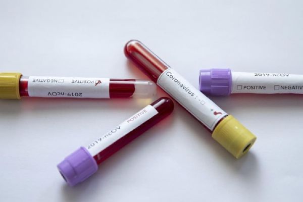 İran'da koronavirüs kaynaklı can kaybı 7 bini geçti