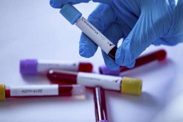 İngiltere'de Kovid-19 belirtileri arasına tat ve koku alma kaybı da eklendi