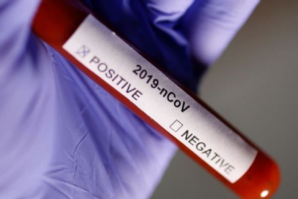 Bulgaristan'da vaka sayısı 2 bin 259'a yükseldi