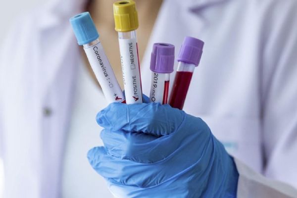 Rusya'da koronavirüs vaka sayısı 300 bini aştı