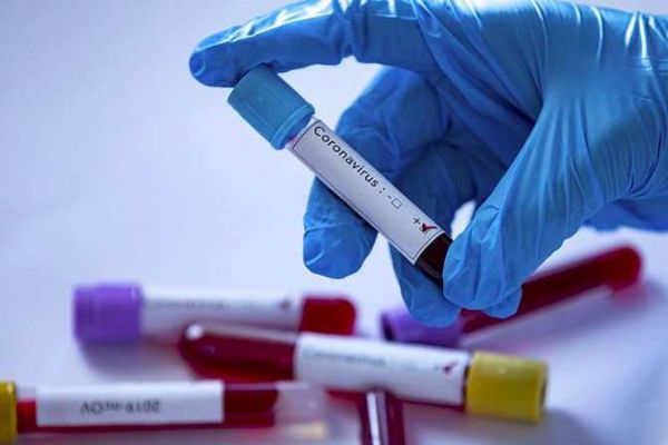 Türkiye'ye korona virüs nereden geldi?