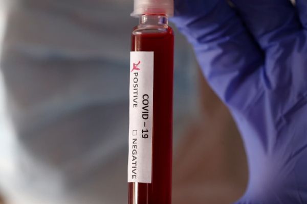 İran'da koronavirüs kaynaklı can kaybı 7 bin 183'e yükseldi