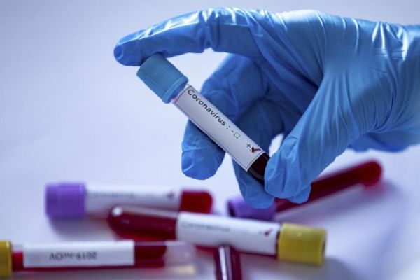 Meksika'da son 24 saatte koronavirüsten 334 kişi öldü