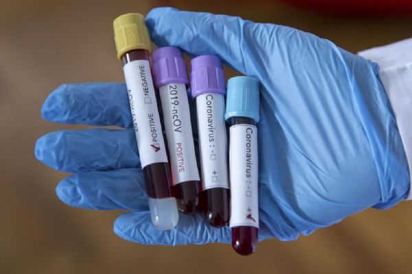 Brezilya'da koronavirüs bilançosu ağırlaşıyor