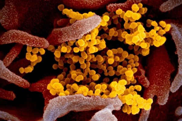 Dünya genelinde koronavirüs vaka sayısı 5 milyon 100 bini aştı